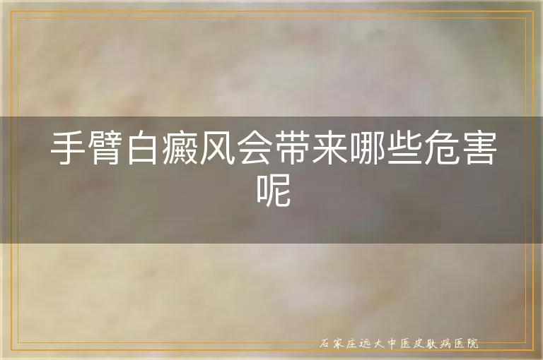 手臂白癜风会带来哪些危害呢