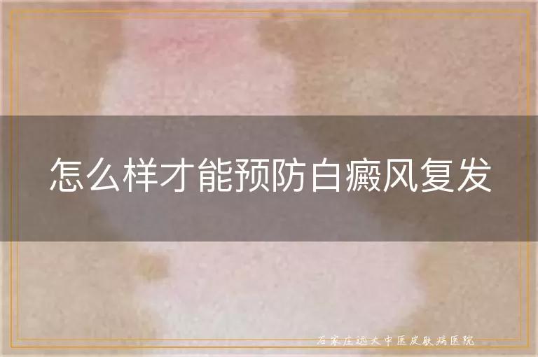 怎么样才能预防白癜风复发