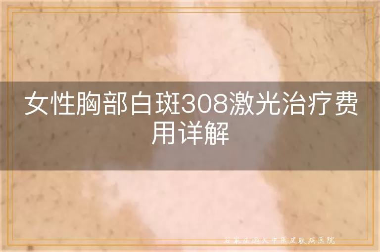 女性胸部白斑308激光治疗费用详解