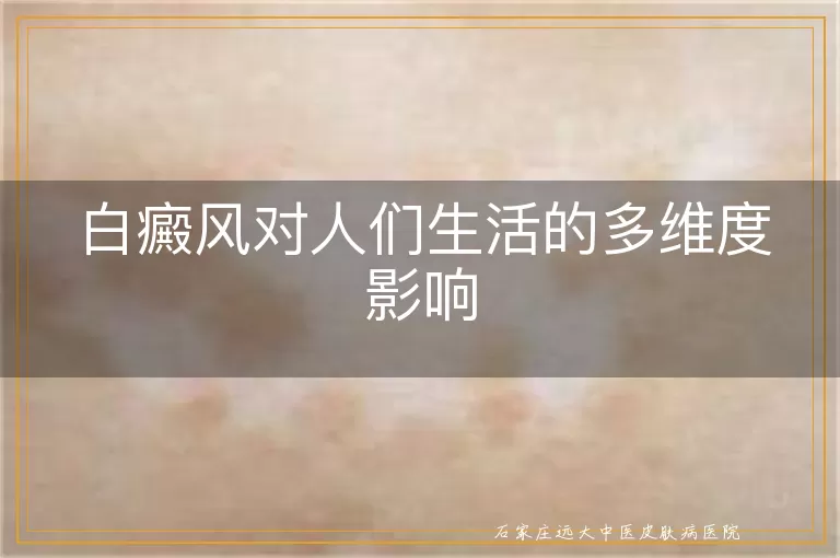 白癜风对人们生活的多维度影响