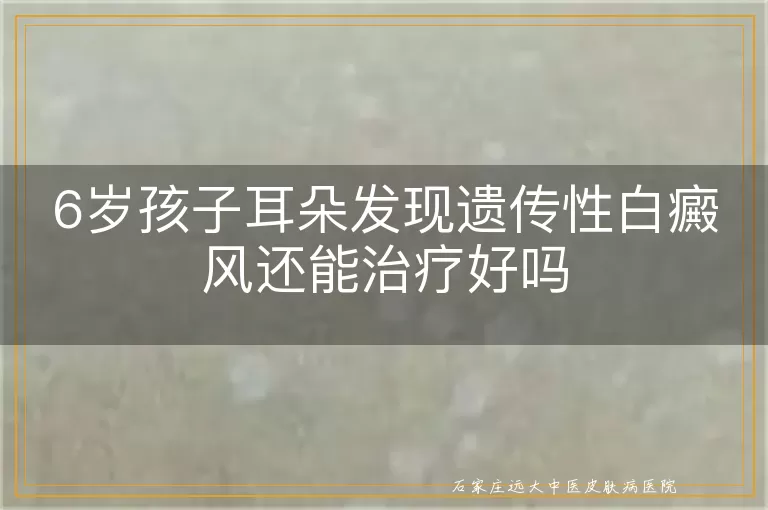 6岁孩子耳朵发现遗传性白癜风还能治疗好吗