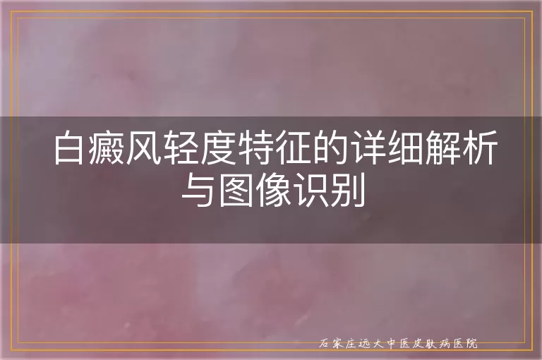 白癜风轻度特征的详细解析与图像识别