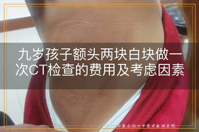 九岁孩子额头两块白块做一次CT检查的费用及考虑因素