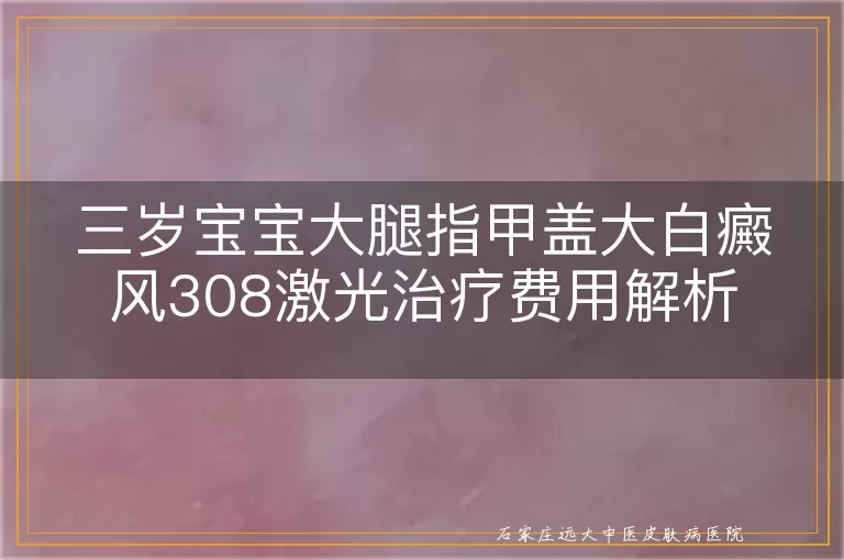 三岁宝宝大腿指甲盖大白癜风308激光治疗费用解析