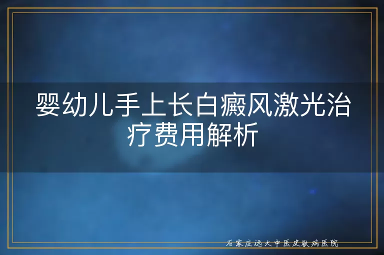 婴幼儿手上长白癜风激光治疗费用解析