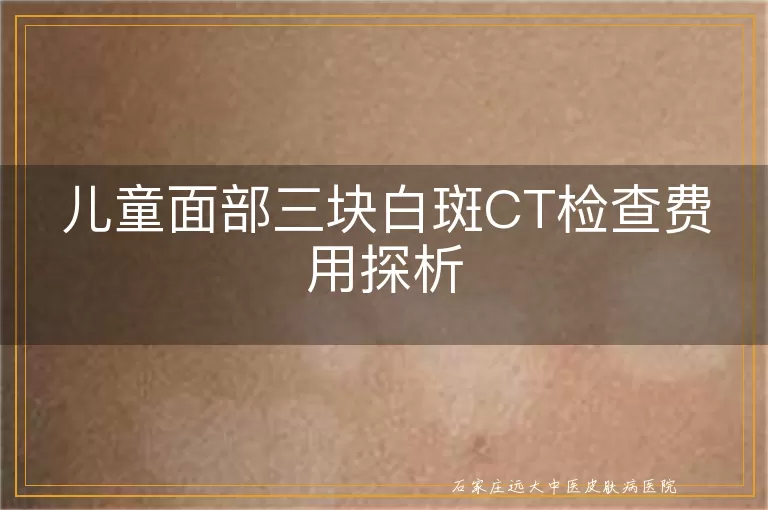 儿童面部三块白斑CT检查费用探析