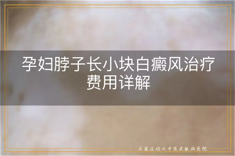 孕妇脖子长小块白癜风治疗费用详解