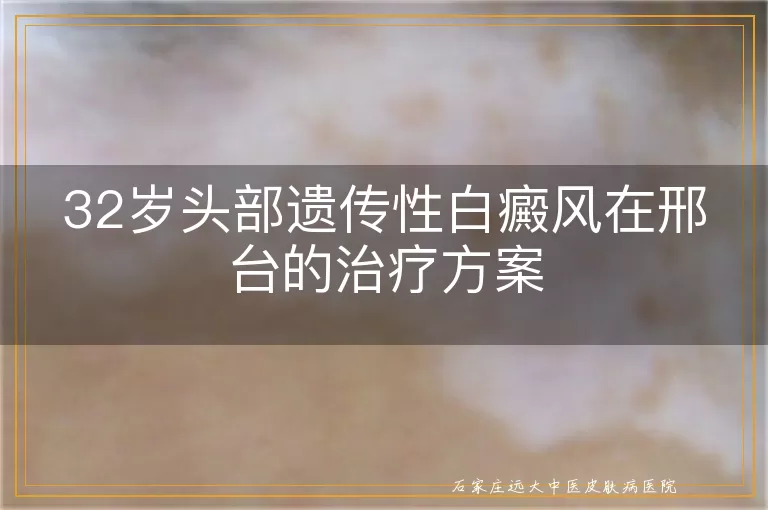 32岁头部遗传性白癜风在邢台的治疗方案