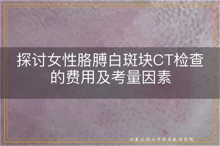 探讨女性胳膊白斑块CT检查的费用及考量因素