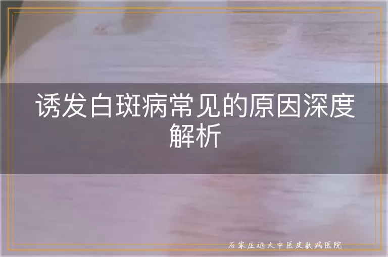 诱发白斑病常见的原因深度解析