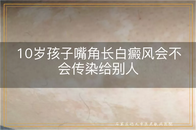 10岁孩子嘴角长白癜风会不会传染给别人
