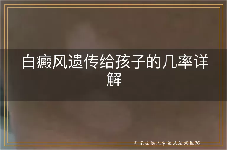 白癜风遗传给孩子的几率详解
