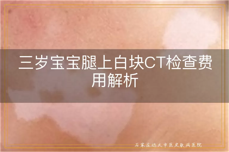 三岁宝宝腿上白块CT检查费用解析