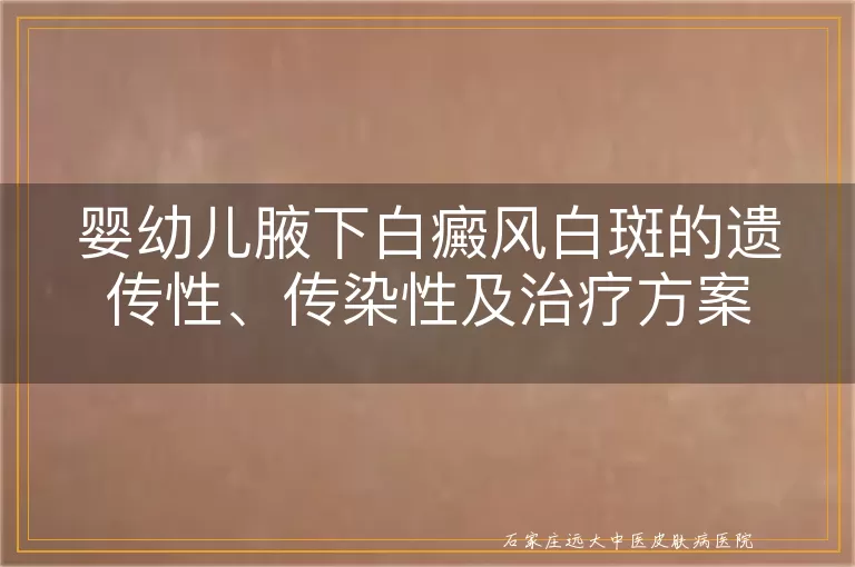 婴幼儿腋下白癜风白斑的遗传性、传染性及治疗方案
