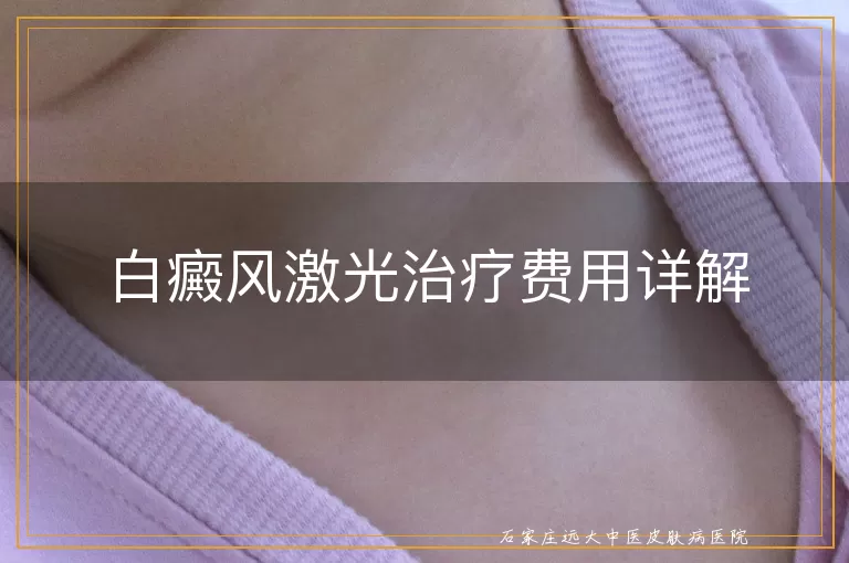 白癜风激光治疗费用详解