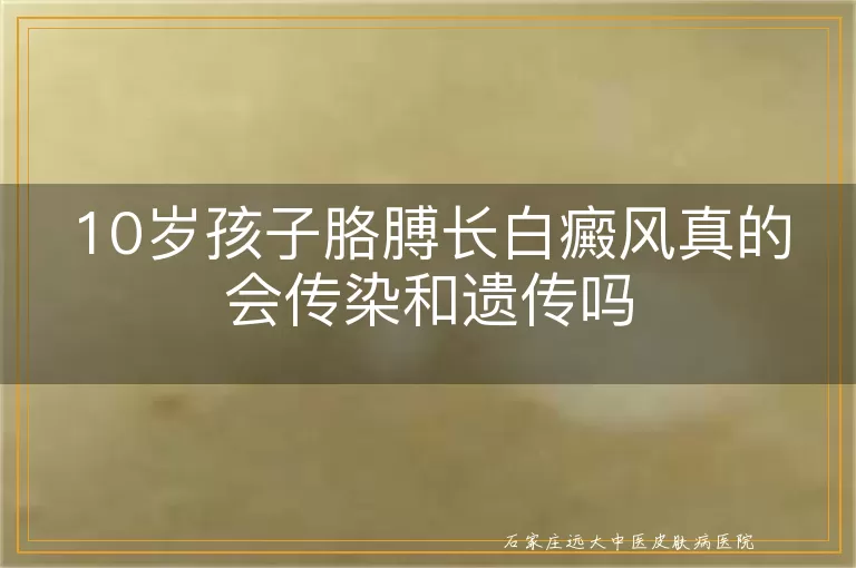 10岁孩子胳膊长白癜风真的会传染和遗传吗