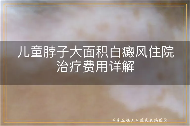 儿童脖子大面积白癜风住院治疗费用详解