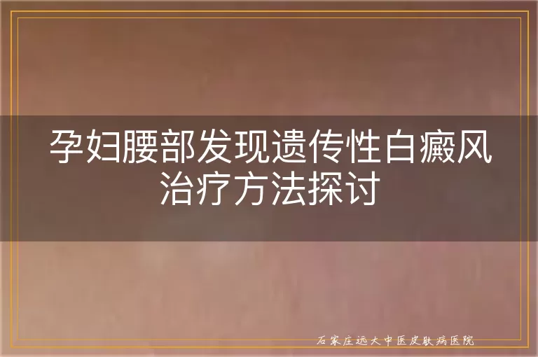 孕妇腰部发现遗传性白癜风治疗方法探讨