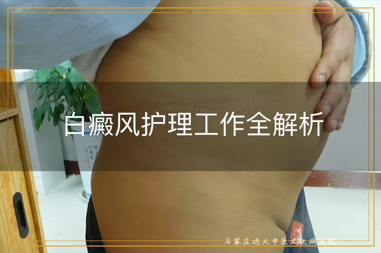 白癜风护理工作全解析