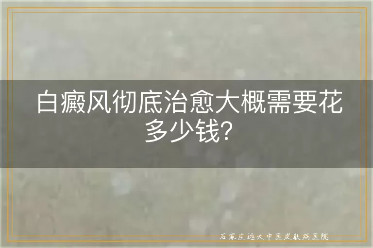 白癜风彻底治愈大概需要花多少钱？