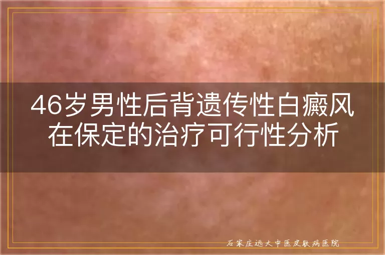 46岁男性后背遗传性白癜风在保定的治疗可行性分析