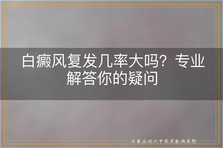 白癜风复发几率大吗？专业解答你的疑问