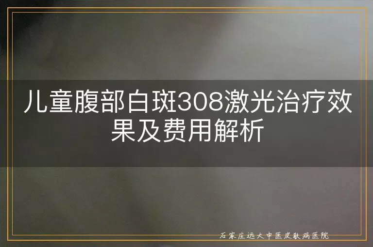 儿童腹部白斑308激光治疗效果及费用解析