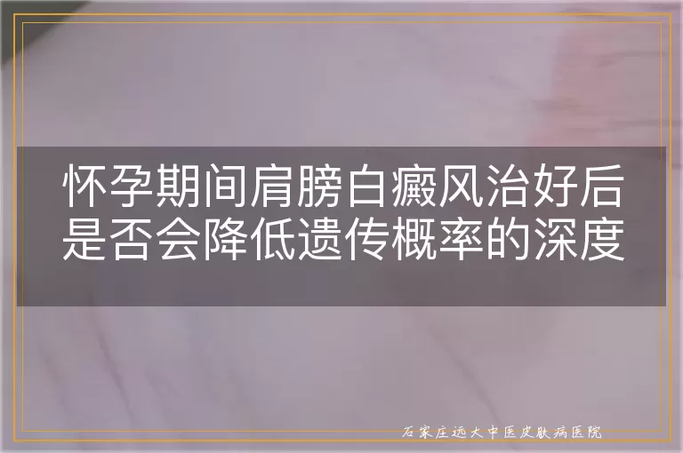 怀孕期间肩膀白癜风治好后是否会降低遗传概率的深度探讨