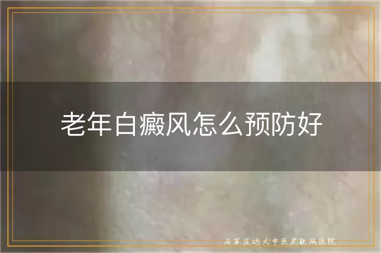 老年白癜风怎么预防好