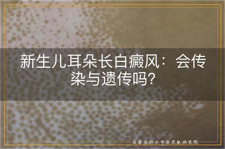新生儿耳朵长白癜风：会传染与遗传吗？