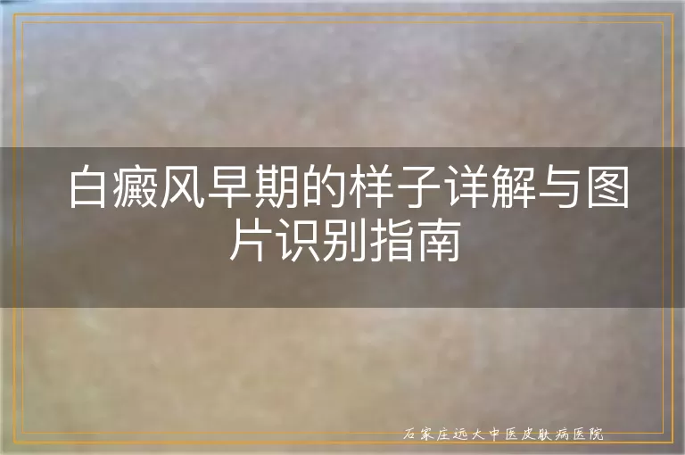 白癜风早期的样子详解与图片识别指南