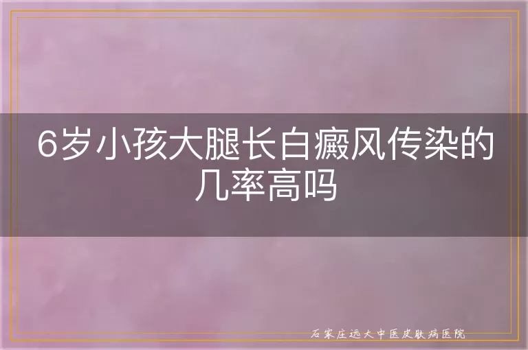6岁小孩大腿长白癜风传染的几率高吗