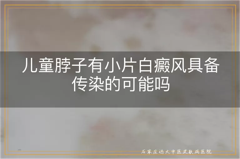 儿童脖子有小片白癜风具备传染的可能吗