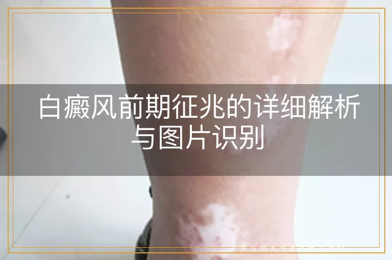 白癜风前期征兆的详细解析与图片识别