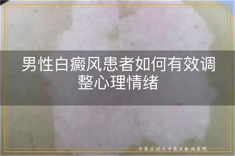 男性白癜风患者如何有效调整心理情绪