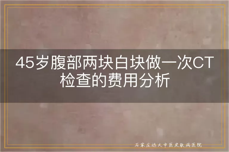 45岁腹部两块白块做一次CT检查的费用分析