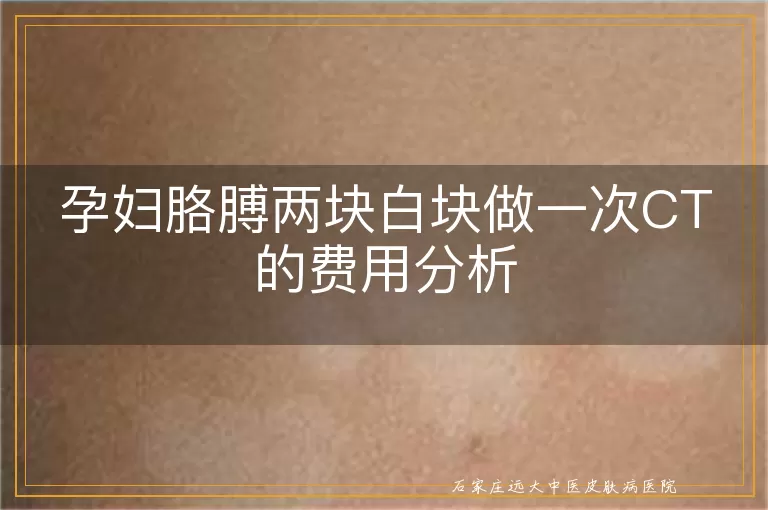 孕妇胳膊两块白块做一次CT的费用分析