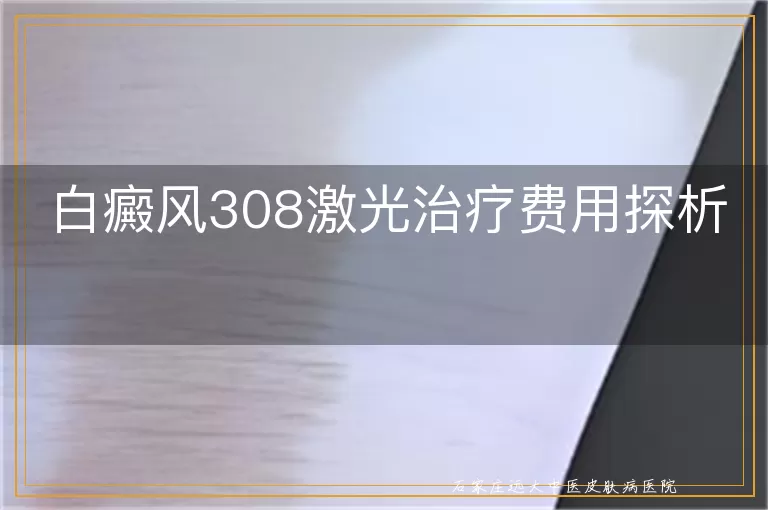白癜风308激光治疗费用探析