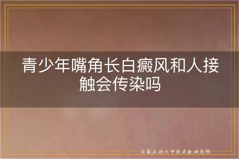 青少年嘴角长白癜风和人接触会传染吗