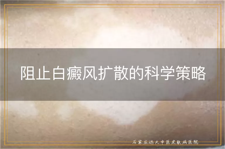 阻止白癜风扩散的科学策略