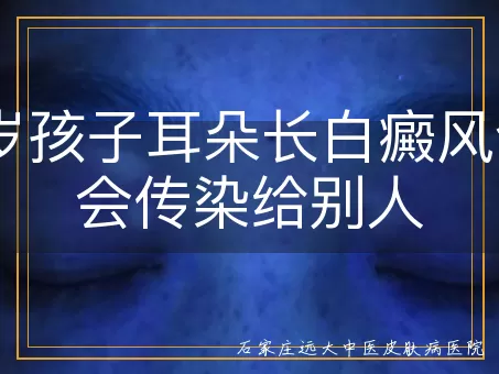 10岁孩子耳朵长白癜风会不会传染给别人
