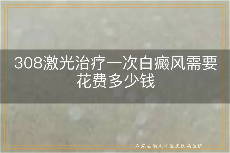308激光治疗一次白癜风需要花费多少钱