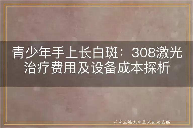 青少年手上长白斑：308激光治疗费用及设备成本探析