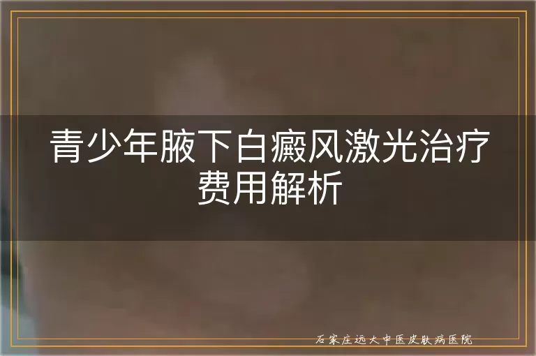 青少年腋下白癜风激光治疗费用解析