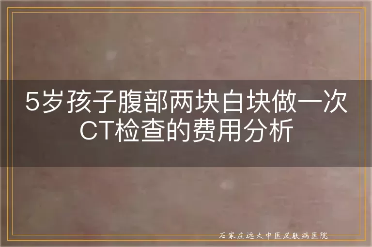 5岁孩子腹部两块白块做一次CT检查的费用分析