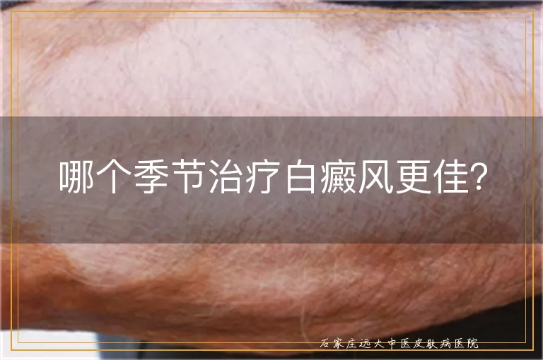 哪个季节治疗白癜风更佳？