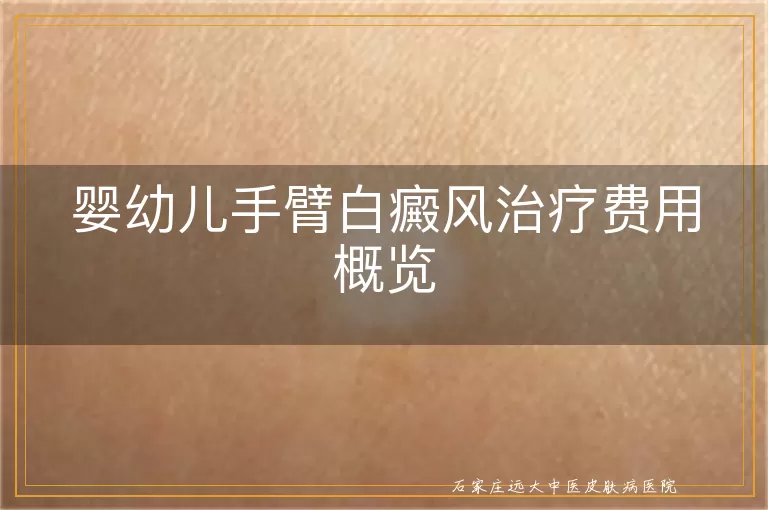 婴幼儿手臂白癜风治疗费用概览