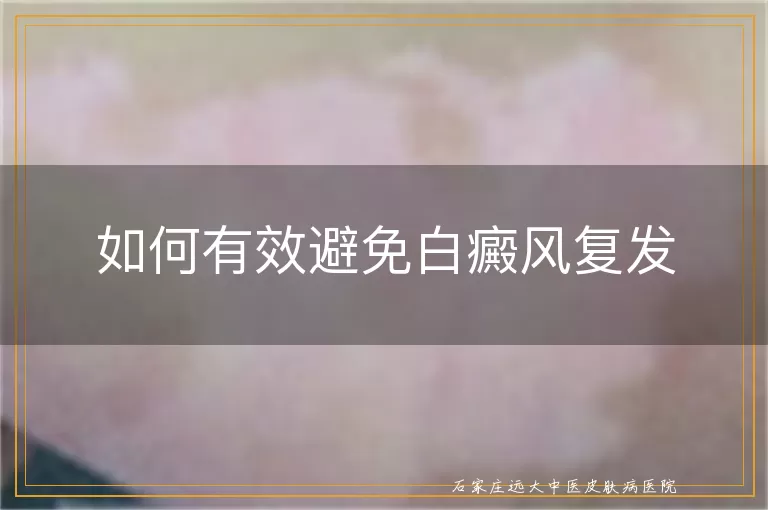如何有效避免白癜风复发