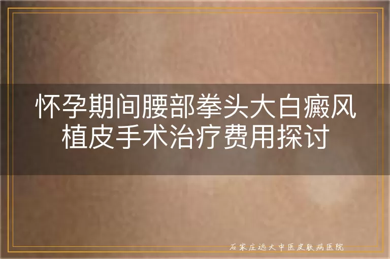 怀孕期间腰部拳头大白癜风植皮手术治疗费用探讨
