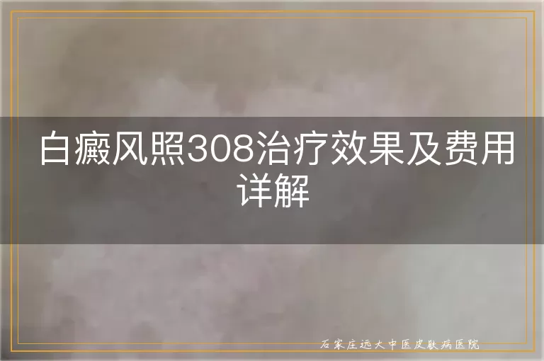 白癜风照308治疗效果及费用详解